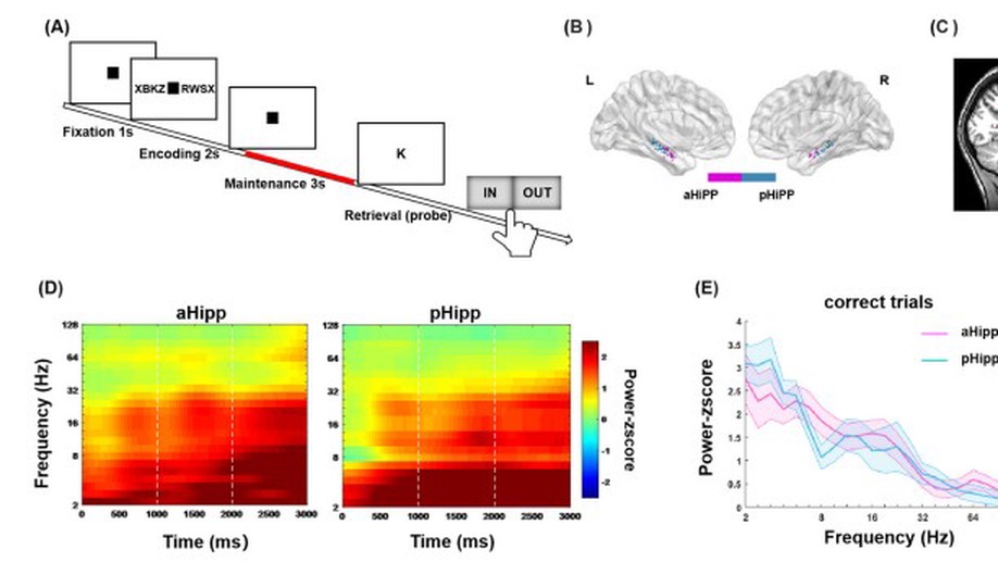 Anterior–Posterior Hippocampal Dynamics Support Working Memory Processing